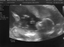20wk ultrasound.jpg